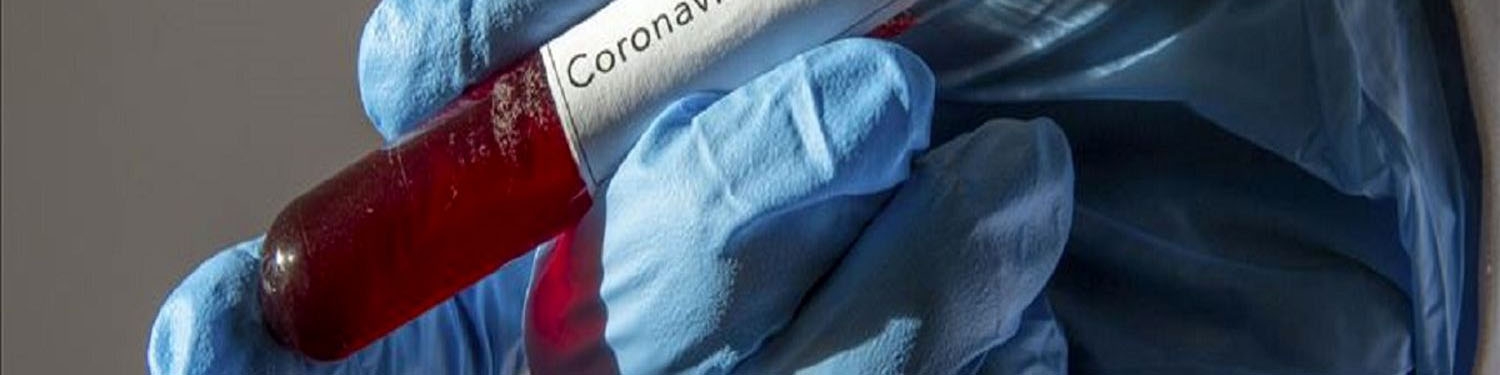 ارائه بسته پیشنهادی اتاق تعاون برای کاهش اثرات کرونا به سران قوا