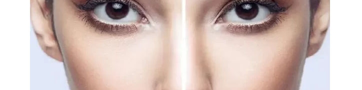 بهترین کاندید برای کاشت ابرو چه خانم هایی هستند؟