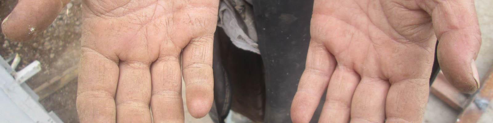 کارگران کمرشکسته